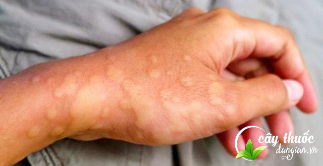 ngua-do-di-ung-thoi-tiet