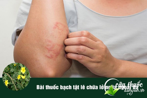 Bài thuốc bạch tật lê chữa lở, ngứa ngoài da được nhiều người áp dụng.