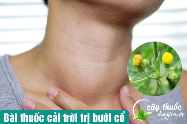 Bài thuốc cải trời chữa bệnh bướu cổ rất tốt