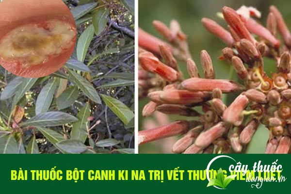 Canh ki na được nhiều người sử dụng làm bài thuốc trị viêm lở loét