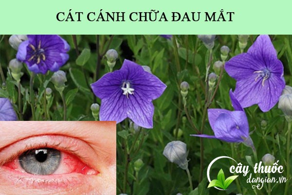 Bài thuốc cát cánh chữa đau mắt được nhiều người áp dụng