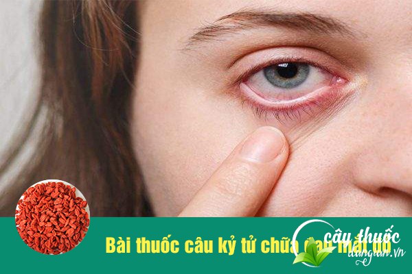 Câu kỷ tử được nhiều người sử dụng làm bài thuốc chữa đau mắt