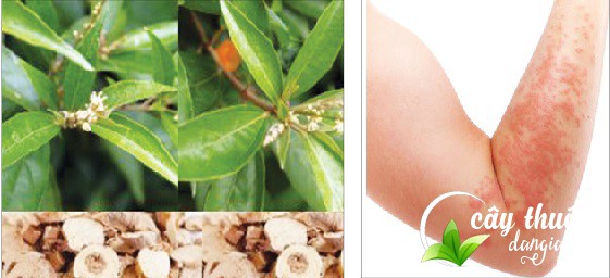 Cây khổ sâm còn có tác dụng chữa các bệnh mẩn ngứa, mẩn đỏ ở da và giúp thanh lọc cơ thể