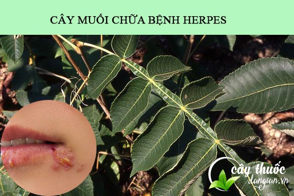 bài thuốc chữa bệnh mụn rộp từ cây muối rừng rất tốt