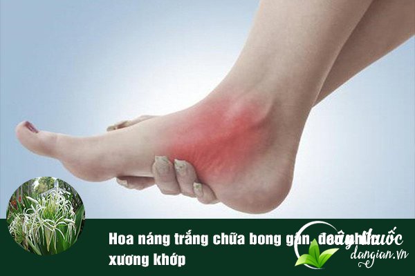Náng trắng thường được dùng để làm bài thuốc chữa bong gân rất tốt và hiệu quả.