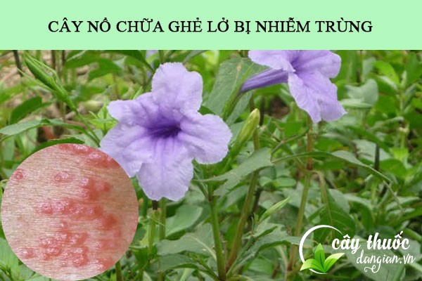 Cây nổ được sử dụng làm bài thuốc chữa ghẻ lở