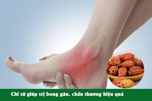 Bài thuốc chi tử chữa bong gân, chấn thương cũng được nhiều người áp dụng