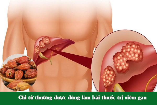 Chi tử được sử dụng để làm bài thuốc chữa viêm gan