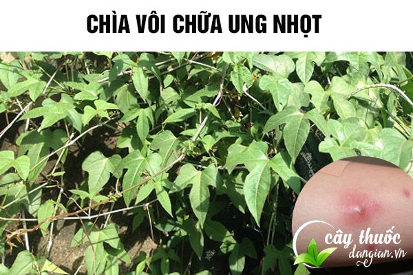 Bài thuốc chìa vôi chữa ung nhọt cũng được nhiều người bệnh áp dụng