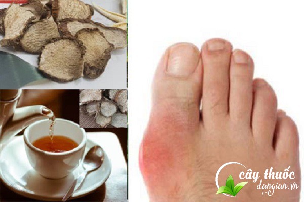 Bài thuốc củ ráy chữa bệnh Gout được nhiều người bệnh áp dụng