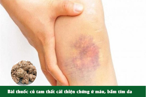 Củ tam thất được biết đến có tác dụng cải thiện chứng ứ máu, bầm tím da.