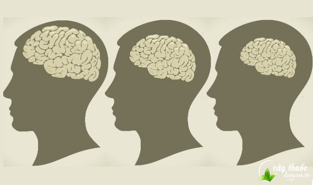 ho-tro-dieu-tri-benh-teo-nao