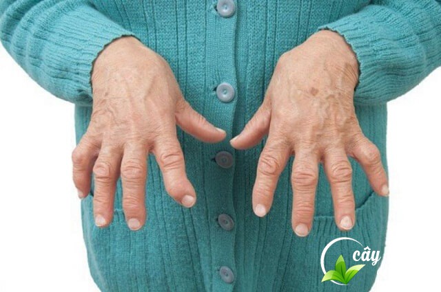 ho-tro-dieu-tri-chung-phong-thap