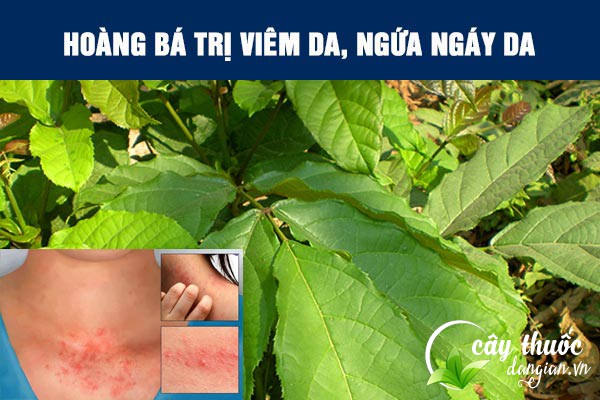 Bài thuốc chữa viêm da, ngứa da từ hoàng bá được nhiều người áp dụng
