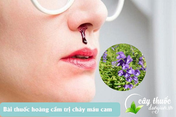 Bài thuốc trị chảy máu cam từ cây hoàng cầm được nhiều người áp dụng