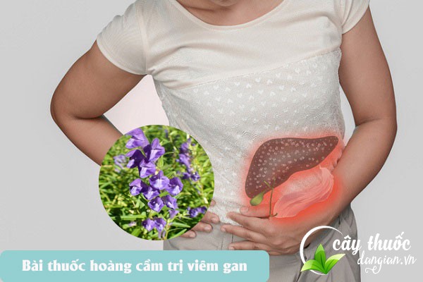 Bài thuốc hoàng cầm trị viêm gan cấp tính