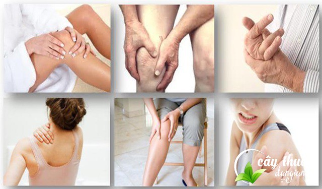 bai-thuoc-ho-tro-chung-dau-nhuc-xuong-khop
