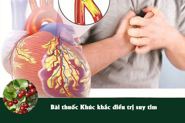 Bài thuốc Khúc khắc chữa suy tim, hồi hộp, lo âu