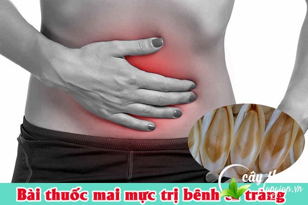 Bài thuốc mai mực trị bệnh dạ dày, tá tràng