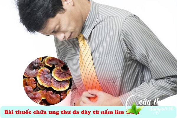 Bài thuốc nấm lim xanh hỗ trợ điều trị bệnh ung thư dạ dày