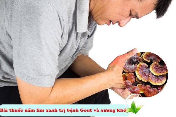 Bài thuốc nấm lim xanh chữa bệnh Gout, xương khớp
