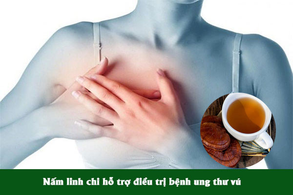 Nấm linh chi hỗ trợ điều trị ung thư vú hiệu quả