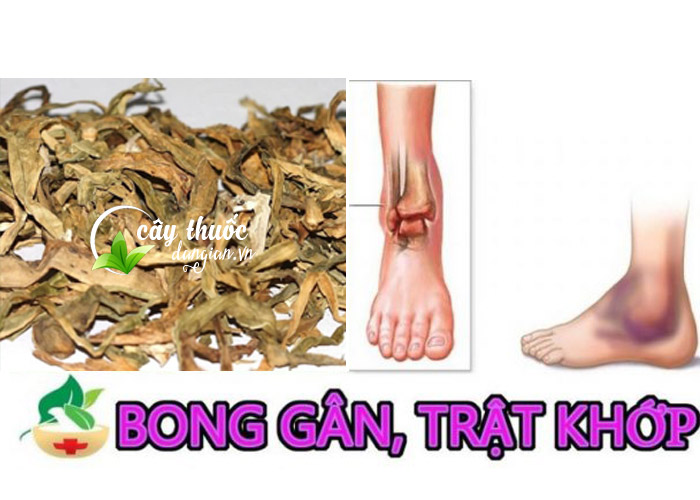 Cây náng hoa trắng chữa trị đau nhức xương khớp, bong gân