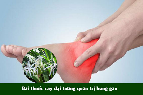 Dân gian thường sử dụng lá náng để điều trị bong gân