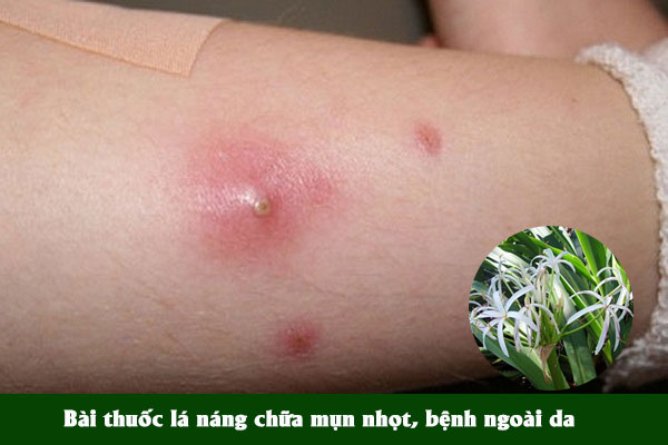 Lá cây đại tướng quân cũng được dùng làm bài thuốc trị mụn nhọt, bệnh ngoài da