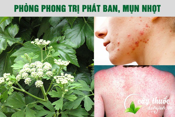 Bài thuốc Phòng phong chữa phát ban, mụn nhọt