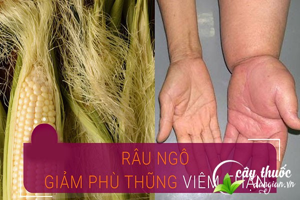 Bài thuốc râu ngô giảm phù thũng, viêm thận