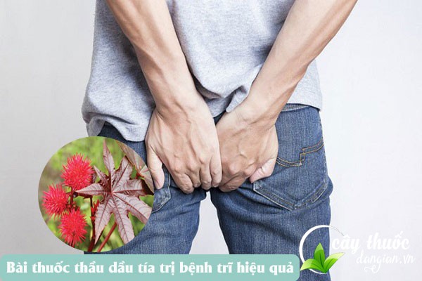 Sử dụng cây thầu dầu tía chữa bệnh trĩ hiệu quả