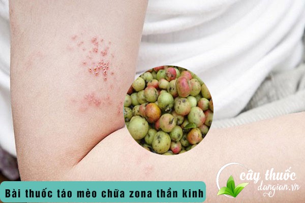 Nhiều người sử dụng táo mèo làm bài thuốc chữa zona thần kinh hiệu quả