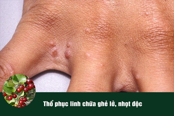 Thổ phục linh được sử dụng làm bài thuốc chữa ghẻ lở.