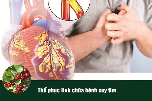 Thổ phục linh được sử dụng làm bài thuốc chữa suy tim, hồi hộp, lo âu, mất ngủ.