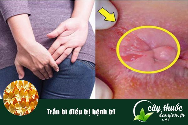 Trần bì giúp chữa bệnh trĩ khá hiệu quả.