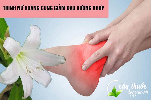 Bài thuốc trinh nữ hoàng cung giảm đau nhức xương khớp