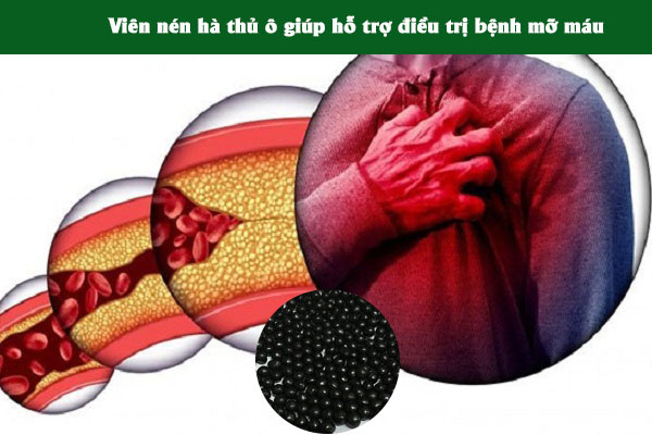 Viên nén hà thủ ô giúp điều trị mỡ máu
