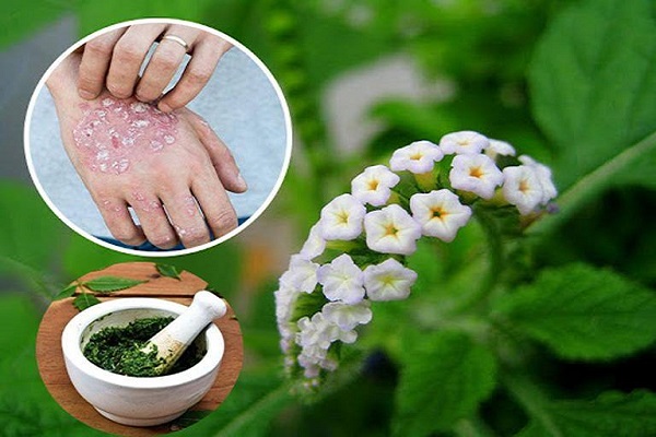 Vòi voi được sử dụng làm bài thuốc chữa bệnh vảy nến khá tốt.