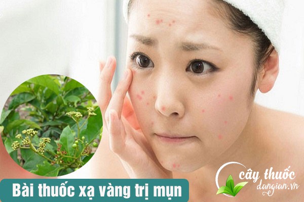 Xạ vàng còn là bài thuốc trị mụn được nhiều chị em áp dugnj